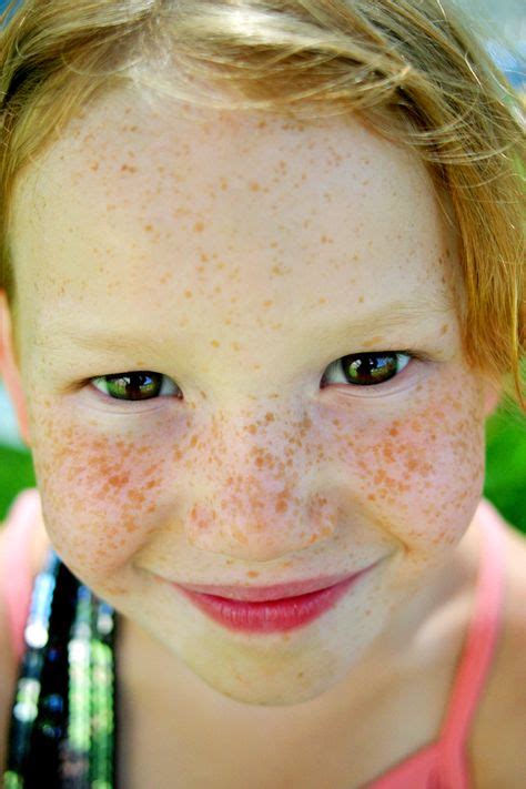 Sun Freckles Freckle Obsession Pinterest