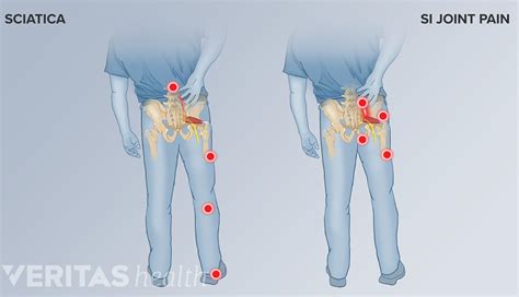 Sacroiliac Si Joint Exercises For Sciatic Pain Spine Health