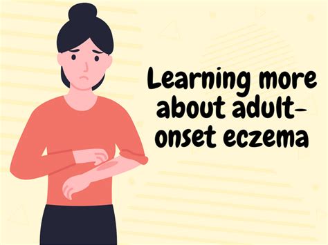 Great Tips On How To Handle Adult Onset Eczema Otranation