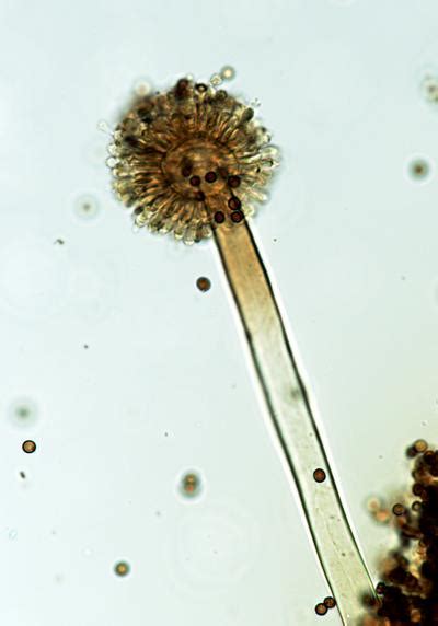 Aspergillus Niger Conid Image Eurekalert Science News Releases