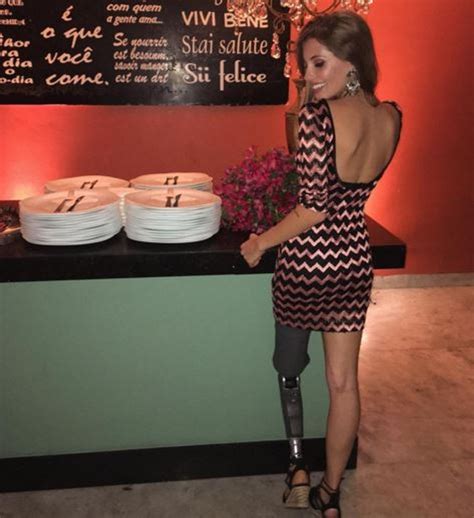 Paola Antonini França Costa Poses With Her Prosthetic Leg To Empower Amputees Good