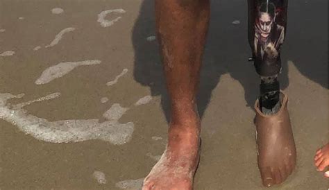 Man Loses Prosthetic Leg While Surfing Asks Public For Help Locating