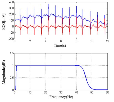 Iir Bandpass Filter Applied To A Normal Type Ecg The Input Temporal Download Scientific
