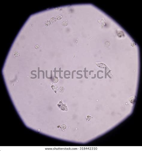 Real Microscope Bacteria Cell Micropedia