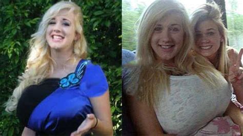 رشد عجیب و غیر عادی اندام این دختر زیبای 17 ساله عکس