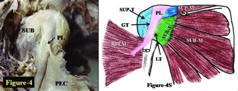 Fibres Of The Subscapularis Inserting Exclusively In The Lesser