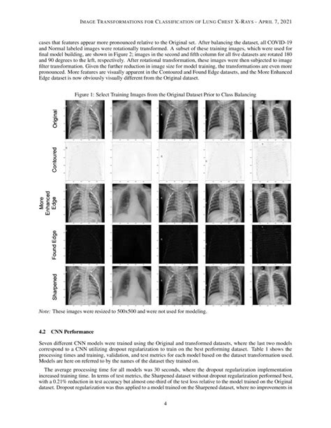 In Line Image Transformations For Imbalanced Multiclass Computer Vision Classification Of Lung