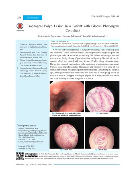 Pdf Esophageal Polyp Lesion In A Patient With Globus Pharyngeus Compliant