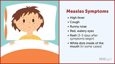 Measles Signs And Symptoms