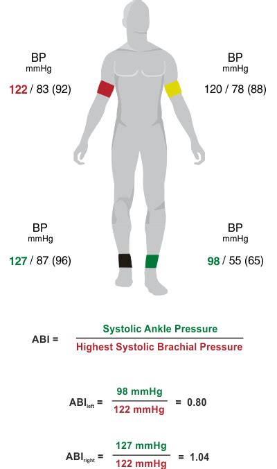 Ankle Brachial Index Abi Medis Gmbh