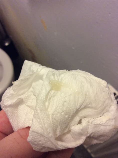 Is This Mucus Plug Or Discharge