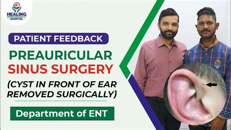 Preauricular Sinus Surgery Ear Cyst Removed Surgically Dept Of Ent