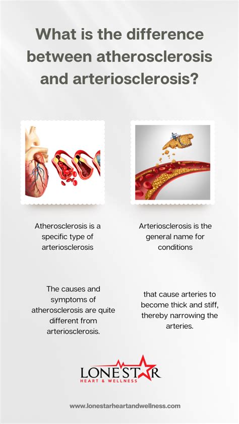 Arteriosclerosis Symptoms Causes And Treatment In Waco Tx
