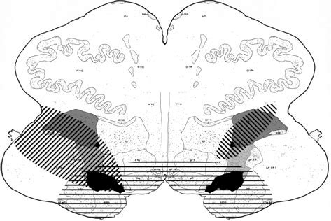 Rostral Medulla Oblongata Plate XIV Cross Section N 1801 Brainstem