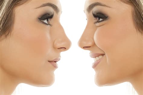 Nose Straightening Your Cosmetic Clinic