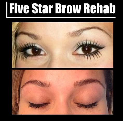 Five Star Brow Rehab If You Have Sparse Eyebrows Due To Over Waxing