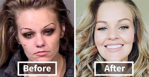 stunning before and after transformations of people who quit drugs gloss