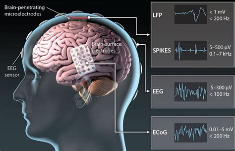 Translating The Brain Machine Interface Science Translational Medicine