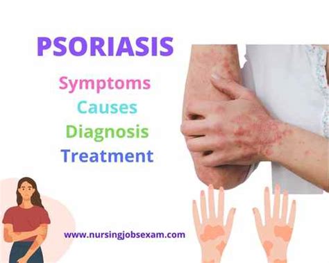 Psoriasis Symptoms Causes Diagnosis Treatment Nursing Jobs Exam