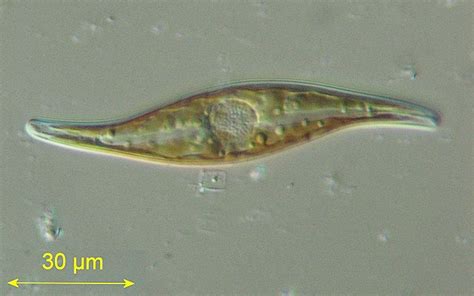 Diatom And Desmid Photomicrographs Diatom Protists Pond Life