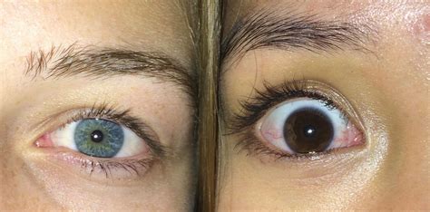 Blue Eyes Vs Brown Eyes Contrast
