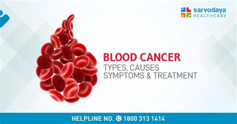 Blood Cancer Types Causes Symptoms And Treatment