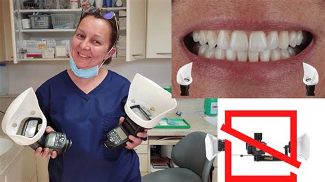 How To Take Studio Style Dental Photos Protrusive Dental Podcast