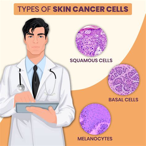 Understanding The Different Types Of Skin Cancer And Treatment Zeeva Clinic