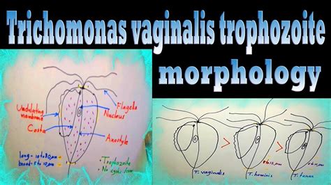 Trichomonas Vaginalis Morphology How To Differentiate From Other Trichomonas Spp YouTube