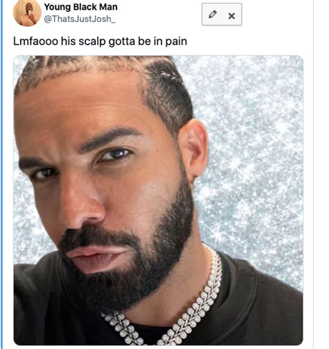 Drake Shows Off New Braids Photos
