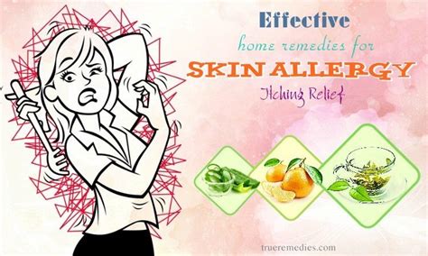 17 Effective Home Remedies For Skin Allergy Itching Relief
