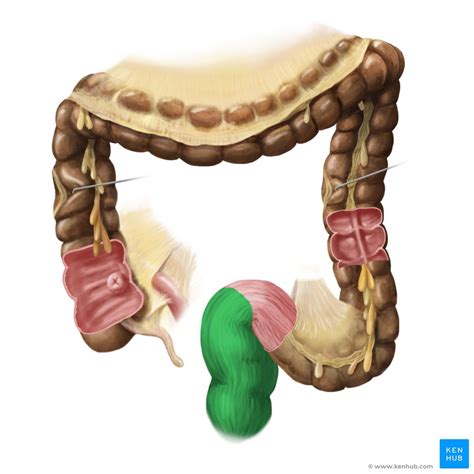 Illustration Of A Cross Section Of The Lower Rectum Showing The My