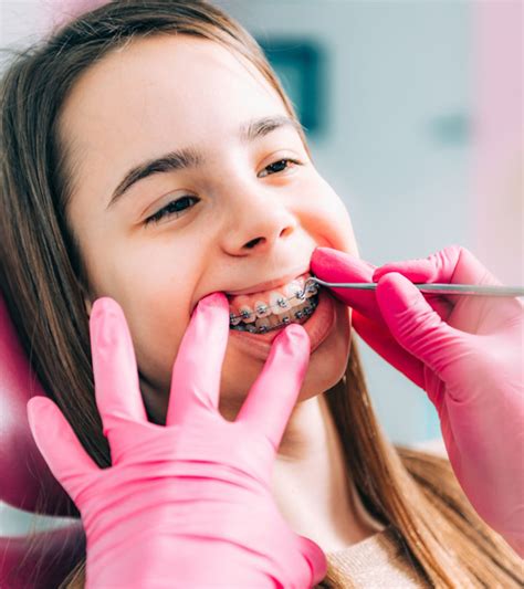 What Age Do Kids Get Braces Types Food And Dental Care