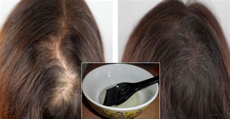 Given that castor oil was a commonly used treatment for a variety of conditions and consumed internally, the unwanted only in a very limited way does organic castor oil help to regrow hair and only indirectly as a result. Castor Oil Hair Loss Treatment - HealthInaSecond.com
