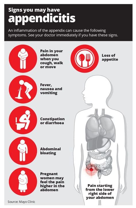 Acute Appendicitis Causes Signs Symptoms Treatment Vrogue Co
