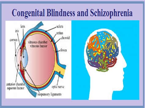 Миф или реальность может ли слепота предотвратить появление шизофрении