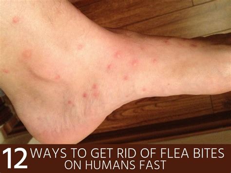 Fleas On Cats To Humans For A Wide Variety Day By Day Account Gallery