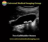 United Medical Imaging Careers Images