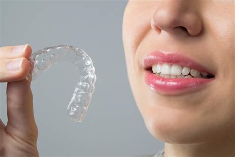How To Take Care Of Your Invisalign Trays Th Street Dental General