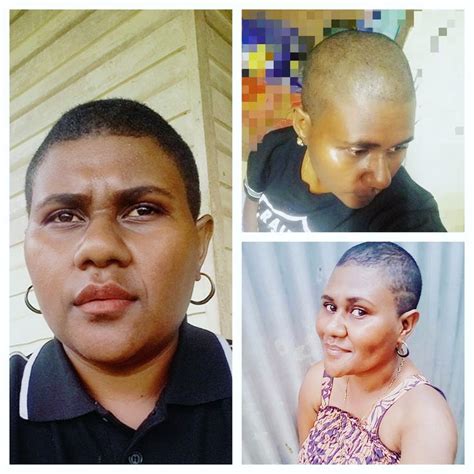 In 1 Month Hair Growth June15july15 2019 5mm Hairjourney Bald