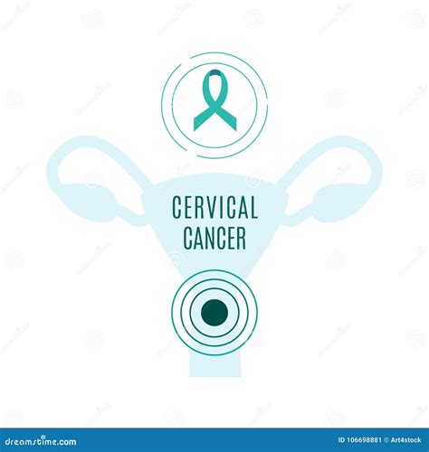 Cervical Cancer Infographic Design Cartoon Vector 182796437