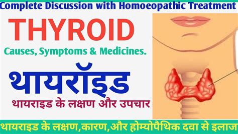 homoeopathic treatment for thyroid [in hindi] hypothyroidism cause symptoms medicine थायरॉइड का