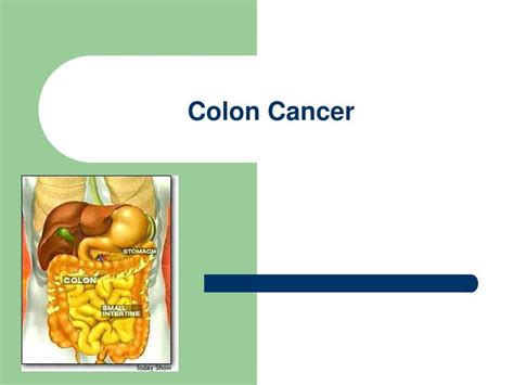 Ppt Colon Cancer Powerpoint Presentation Free Download Id3302233