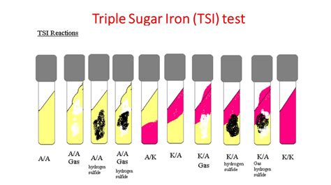 Triple Sugar Iron Agar Tsi Principle Procedure And Interpretation Hot