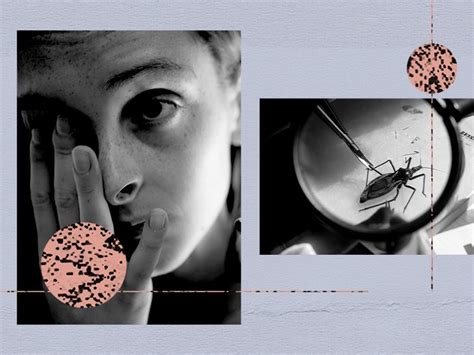 Chagas Disease Symptoms
