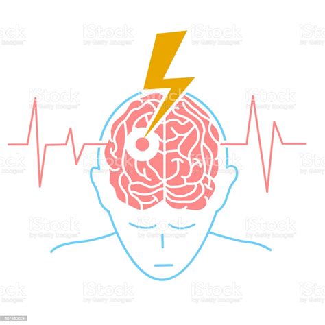 Concept Of The Disease Is A Stroke Stock Illustration