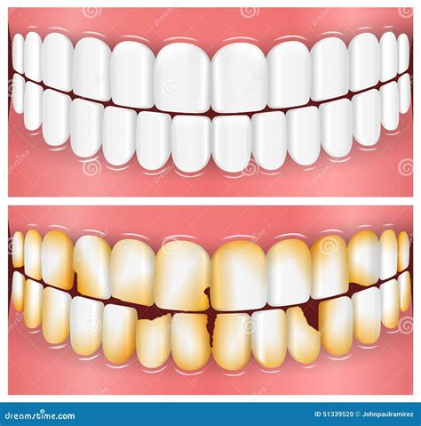 Teeth Mouth Dentistry Stock Illustration Image 51339520