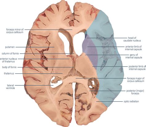 Middle Cerebral Artery