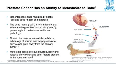 Metastatic Prostate Cancer Prognosis