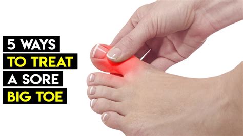 Broken Pinky Toe Recovery What You Should Know About A Broken Pinky Toe